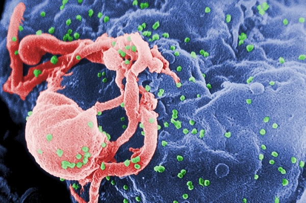 «Спутник» стал первой в мире коронавирусной вакциной, доказательно защищающей ВИЧ-инфицированных